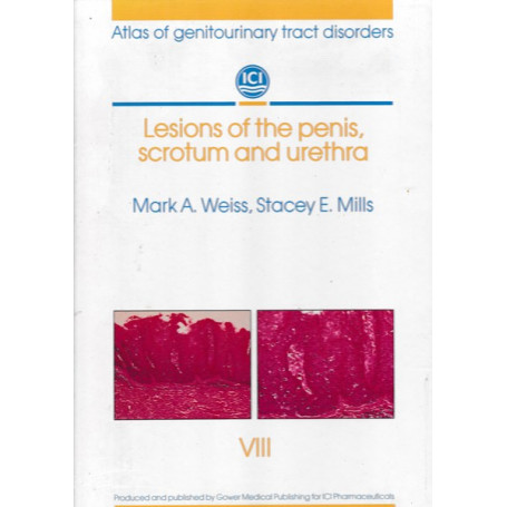 Lesions fo the penis